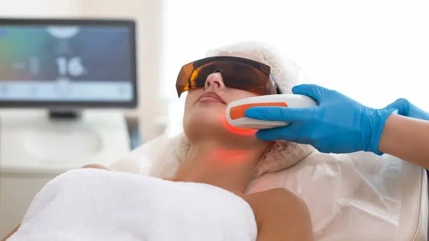 excellentbeauty-c02laser