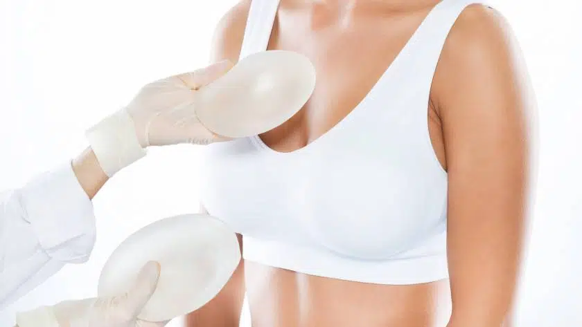 excellentbeauty-implantatwechsel