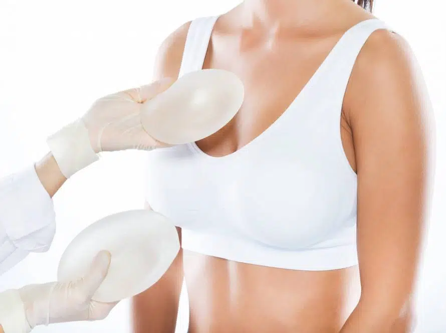 excellentbeauty-implantatwechsel