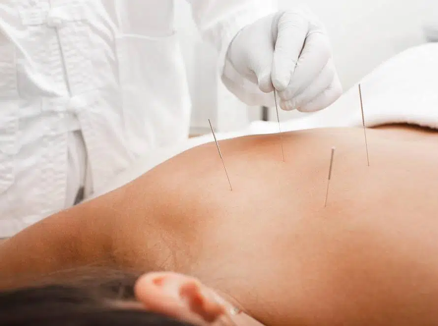 exc.beauty-therapie-akkupunktur