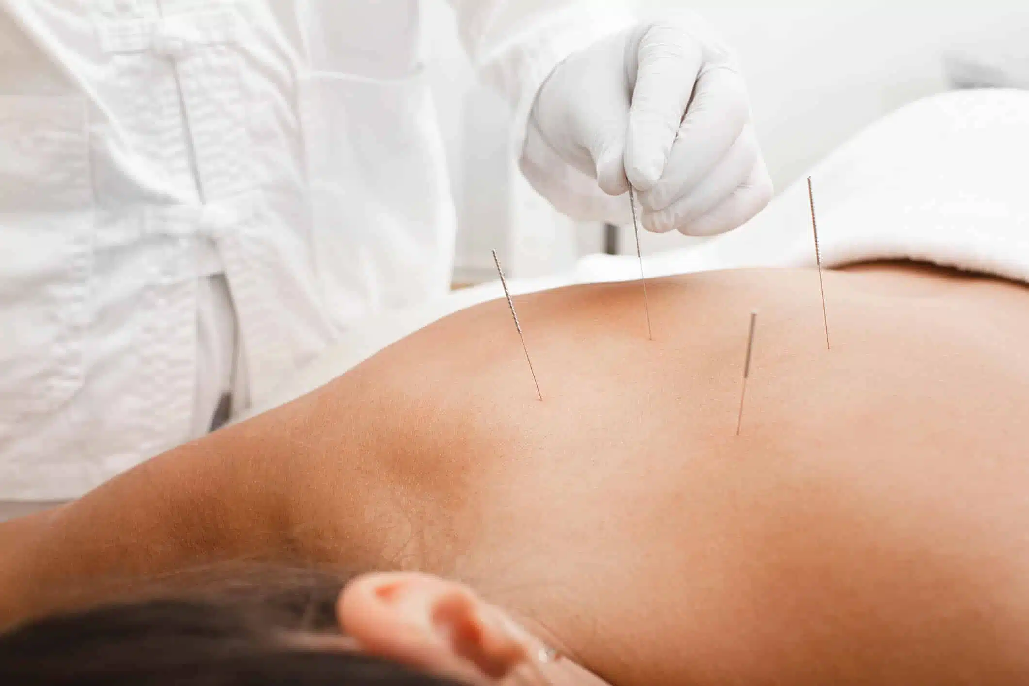 Akupunkturmassage
