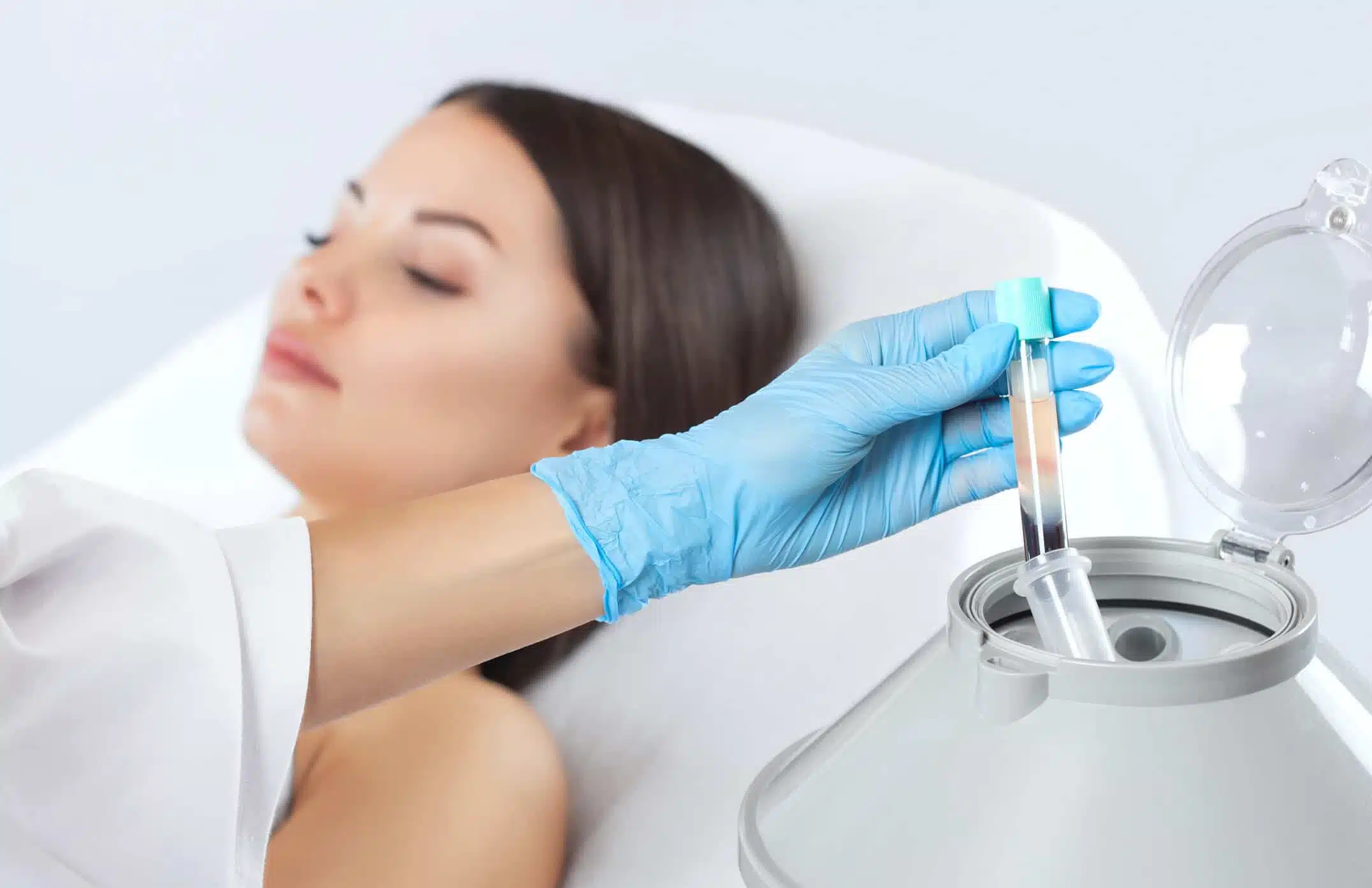 PRP-Therapie