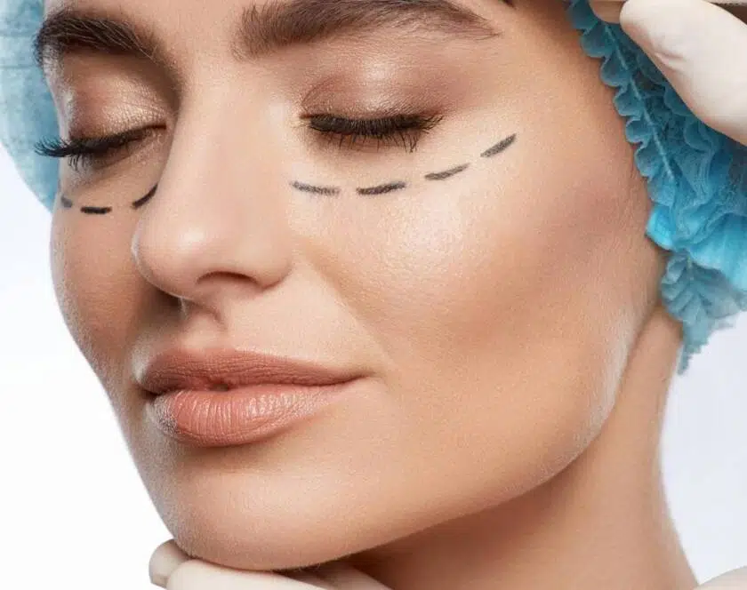 chirurgie-excellentbeauty